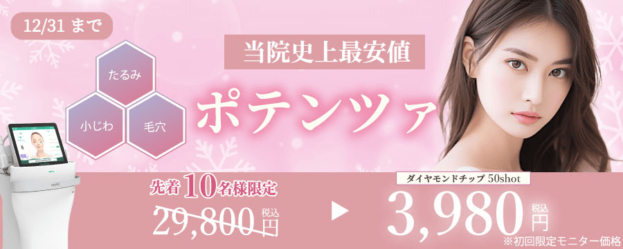 ダイアモンド キャンペーン【ポテンツァ】