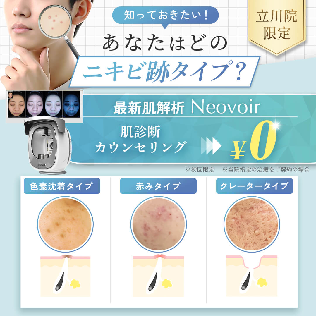 肌診断 0円キャンペーン