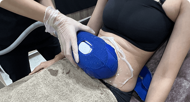 クールスカルプティング エリート l レナータクリニック 新宿・立川