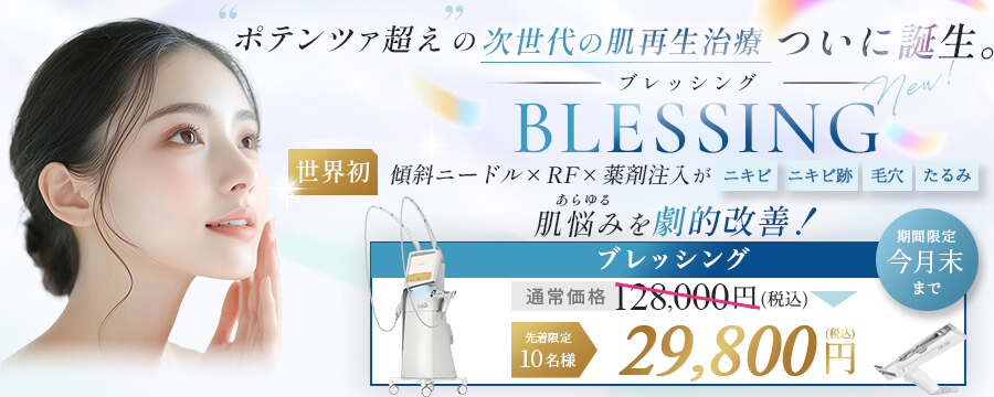ブレッシングキャンペーン バナー