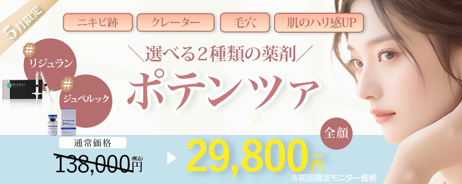 ポテンツァ リジュラン バナー