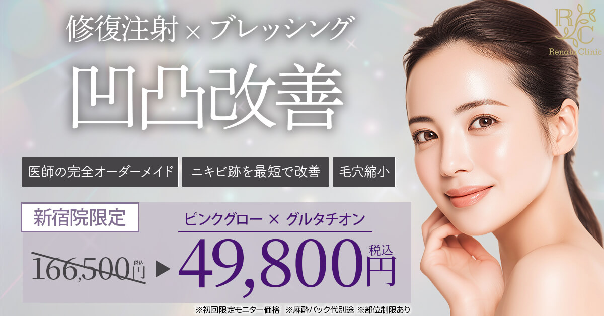 凹凸改善 バナー